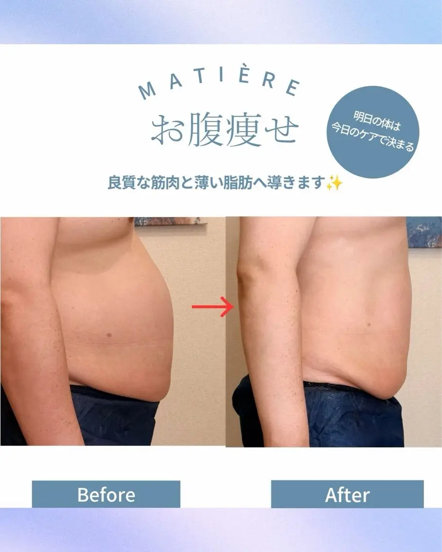 エステ ダイエット&リラク 🌿MATIÈREのエステ・リラクイメージ