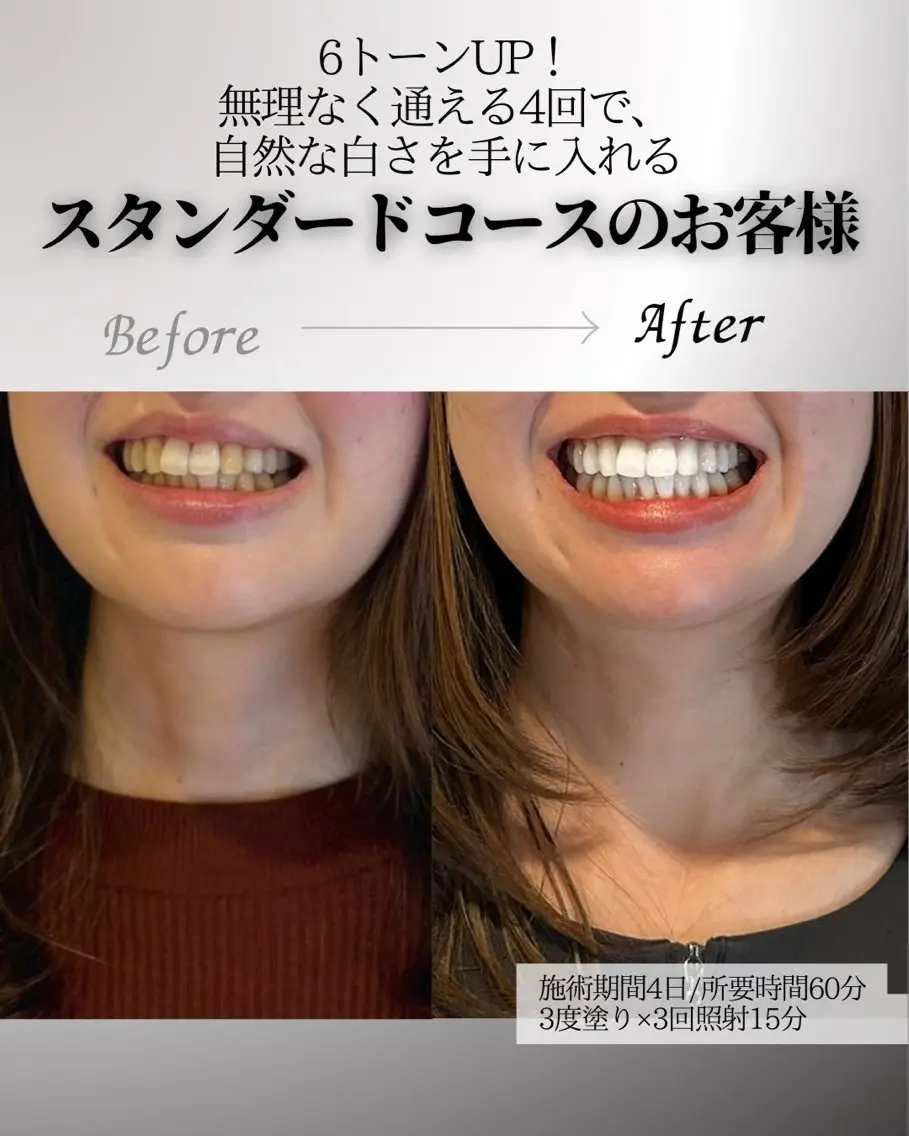歯科提携エラン ホワイトニング一社店のその他イメージ