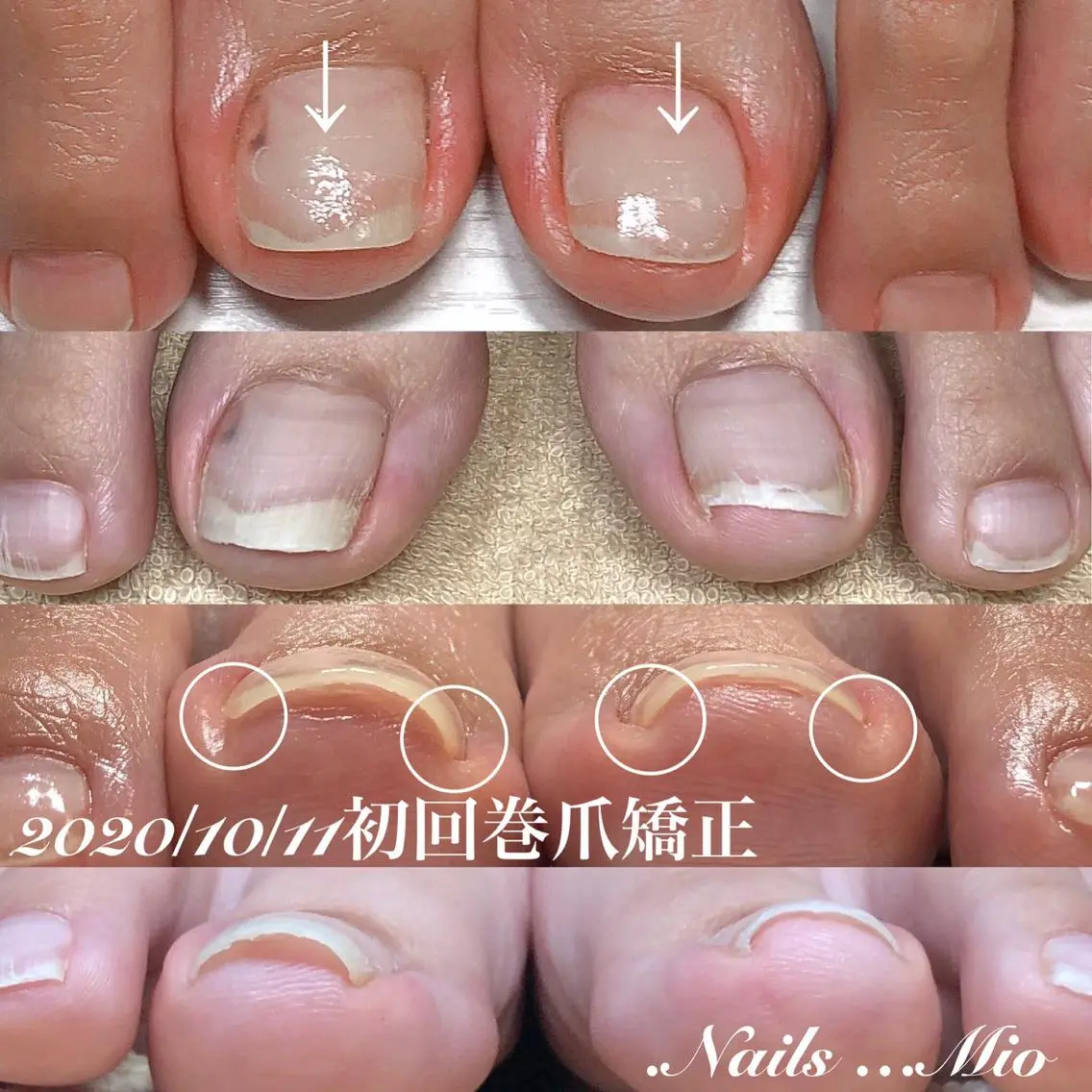 ネイル フットネイル フットネイル .Nails Mio 赤羽西ネイルサロンのネイルデザイン