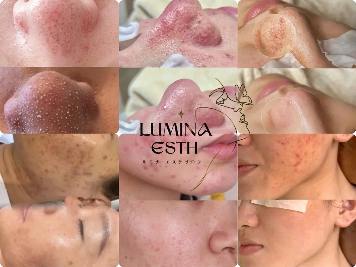 LUMINA ESTHのエステ・リラクイメージ