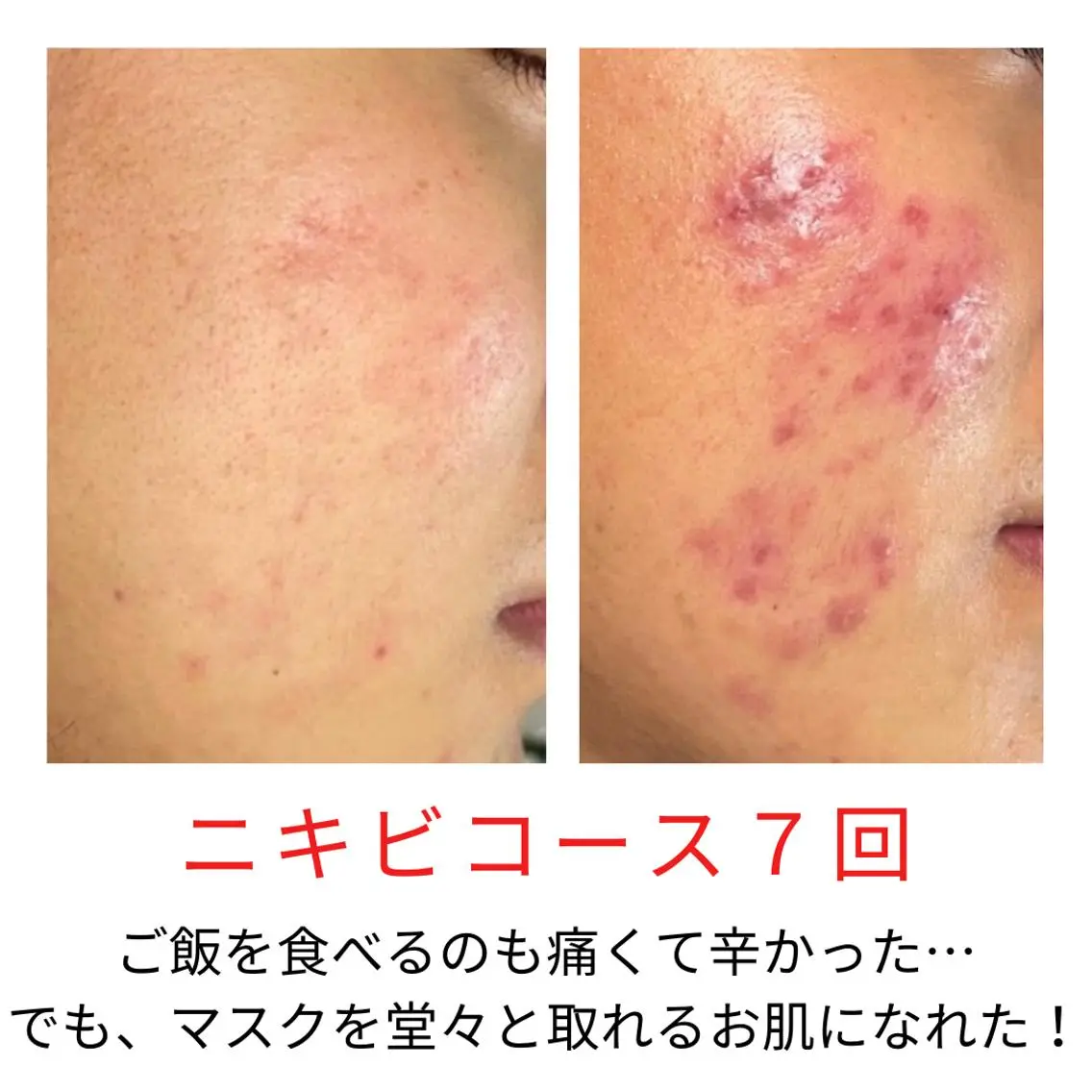 エステ ベラージュ【美背中・ 美尻・フェイシャル】のエステ・リラクイメージ