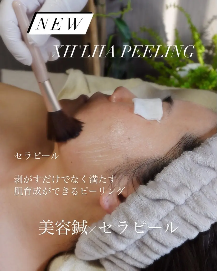 小顔美容鍼×セラピール｜美肌育成コース✨75分 ¥9,900💆‍♀️小顔と美肌を両方叶えたい方におすすめ！の写真