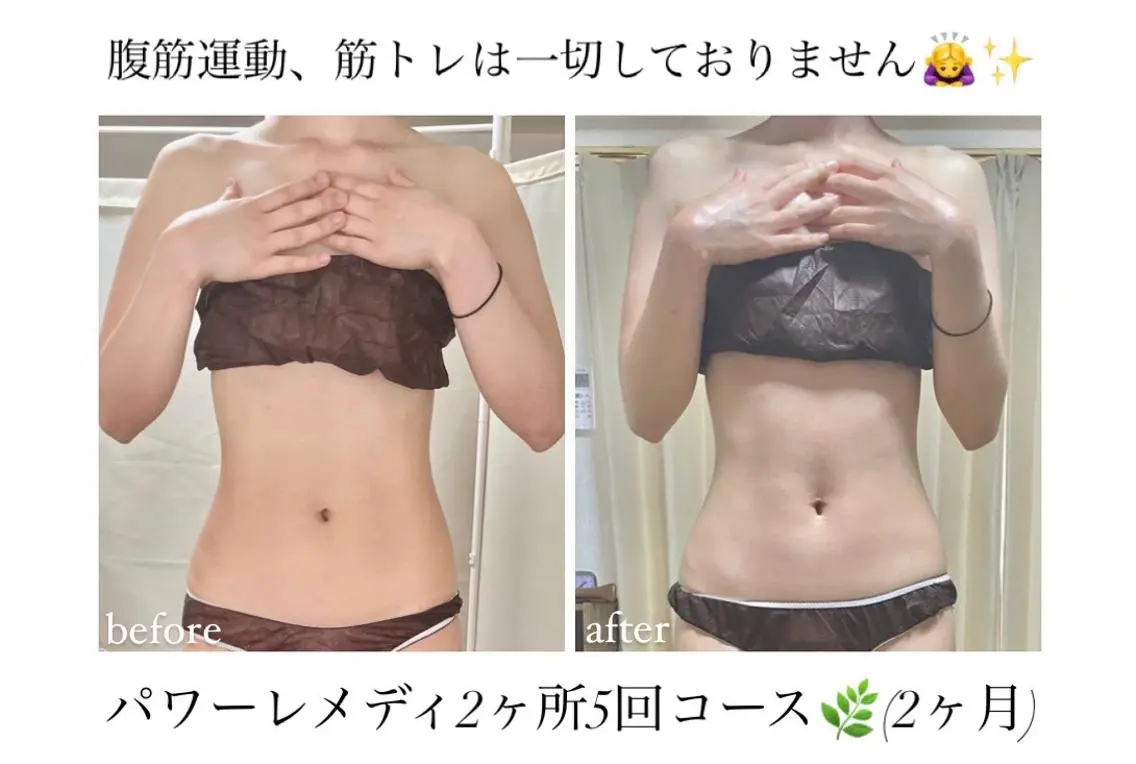 《本気痩せ×疲労改善 》 BILOOPのエステ・リラクイメージ