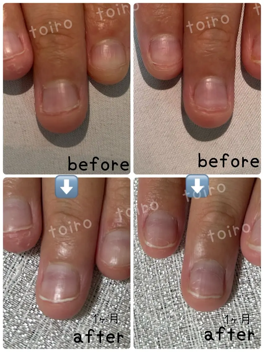 ネイル ネイルケア&自爪育成 専門サロンToiroのネイルデザイン