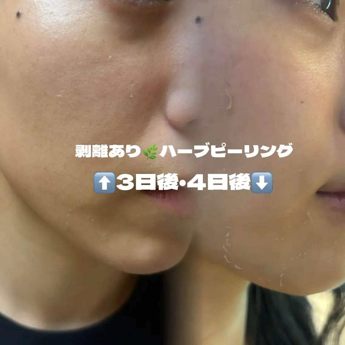 🍃fujita revacell調布のエステ・リラクイメージ