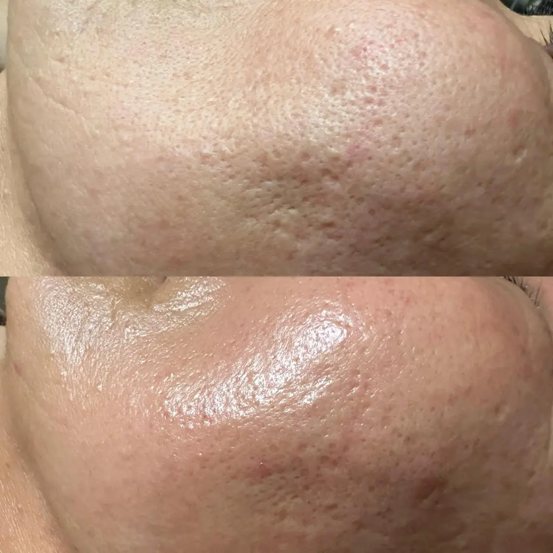 エステ リラク lymph care 'Welnəsのエステ・リラクイメージ