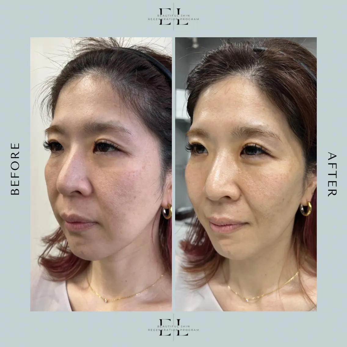 White labo 須谷のエステ・リラクイメージ