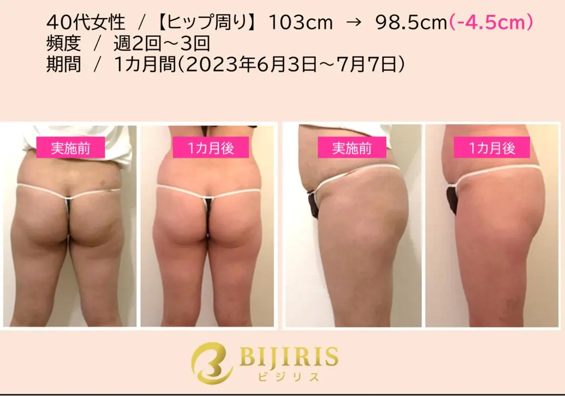 セルフ脱毛/美尻イス キングスサロン熊本のエステ・リラクイメージ