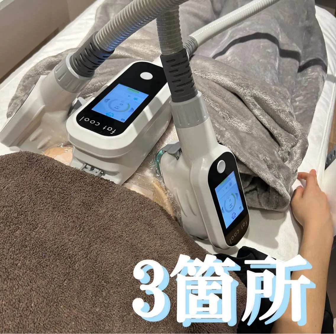 脂肪痩身〈お腹〉初回体験3~4カップの写真
