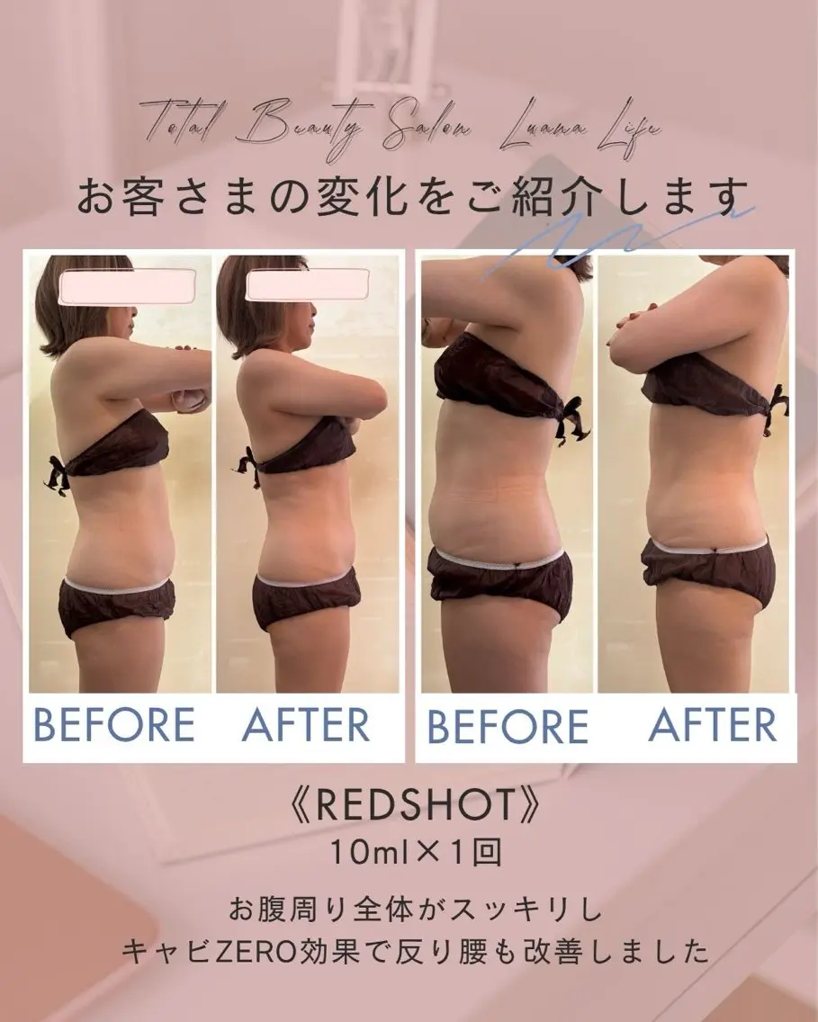 ニキビ跡・肌質改善 LuanaLifeのエステ・リラクイメージ