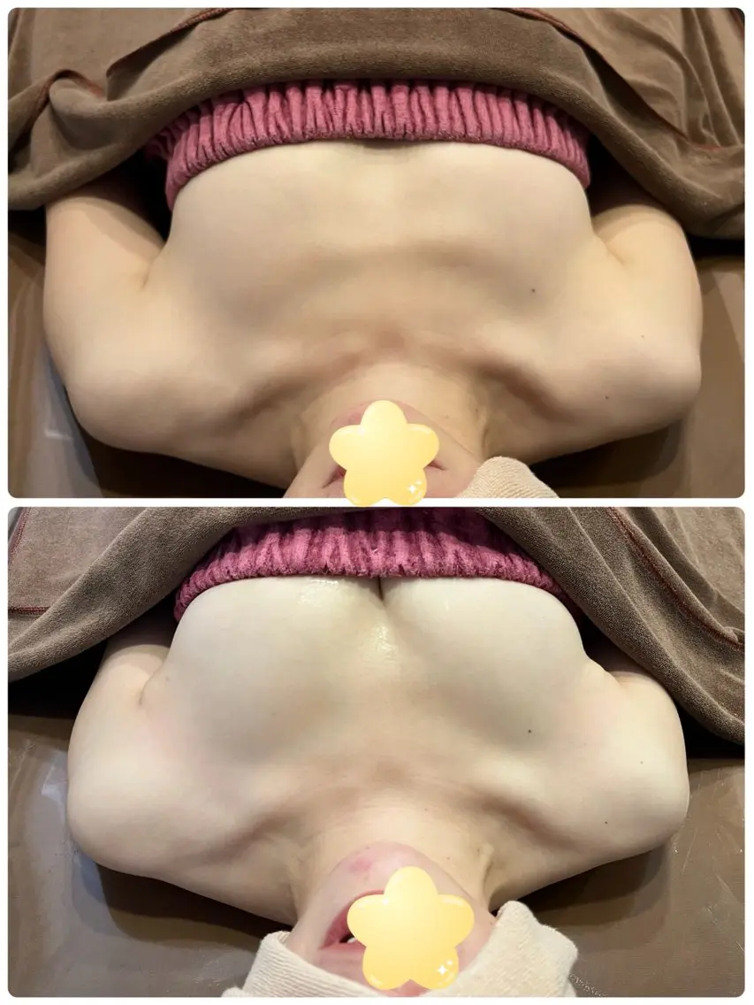 産後のバストもふんわりハリのあるバストへ💓120分（特別カウンセリング込み🥰）通常35,000円の写真