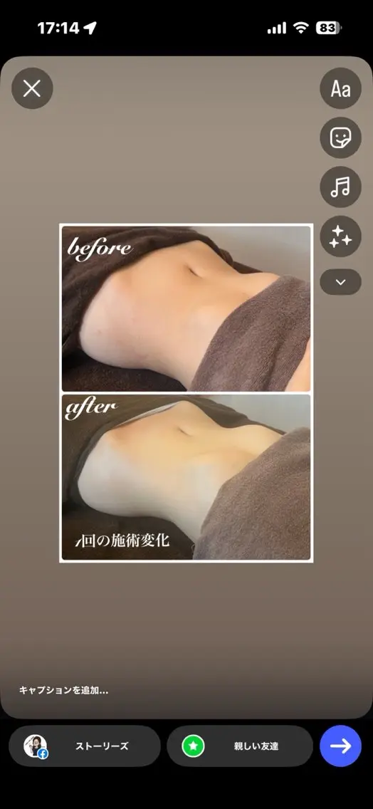 エステ MY_RIRI AZUSAのエステ・リラクイメージ