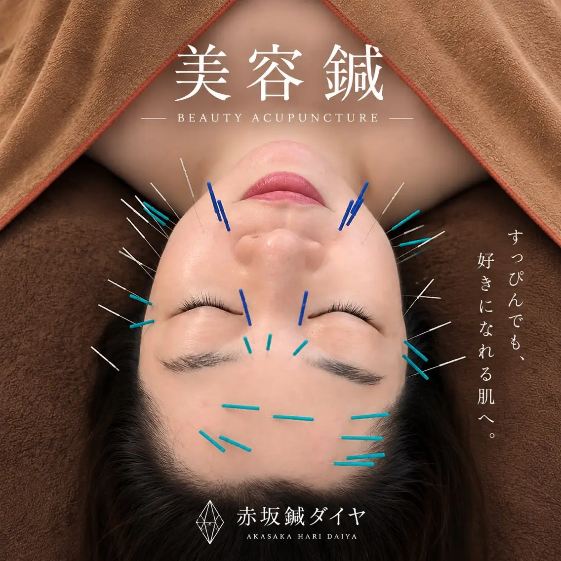【初めての美容鍼に】🌼美容鍼お試し体験🌼 ¥5,500の写真