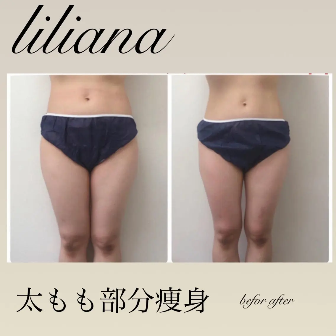 エステ LILIANA ☆YURIのエステ・リラクイメージ