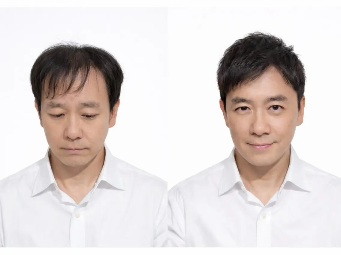 【薄毛に悩む男性専門】メンズカット(シャンプーブロー込)しっかりカウンセリングさせて頂きます!の写真