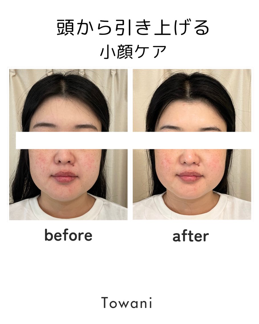 Towani 小顔・ビタミンケアのエステ・リラクイメージ