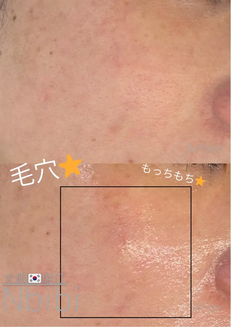 エステ 韓国🇰🇷価格 サロン_Nbibiの眉毛・アイブロウイメージ