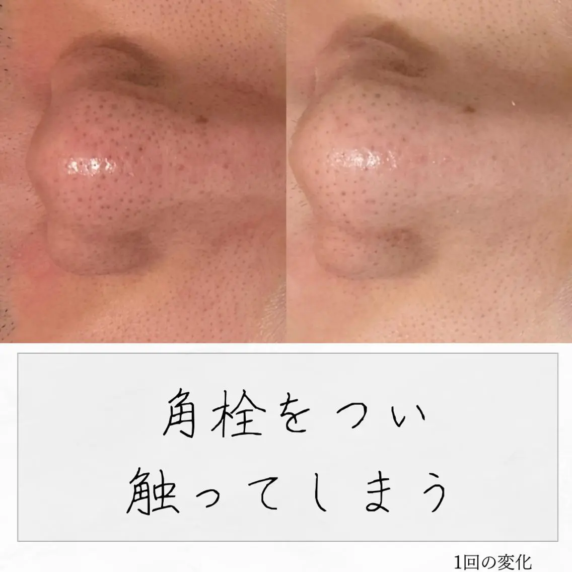 ニキビ経験者が施術 する専門サロン🌻のエステ・リラクイメージ