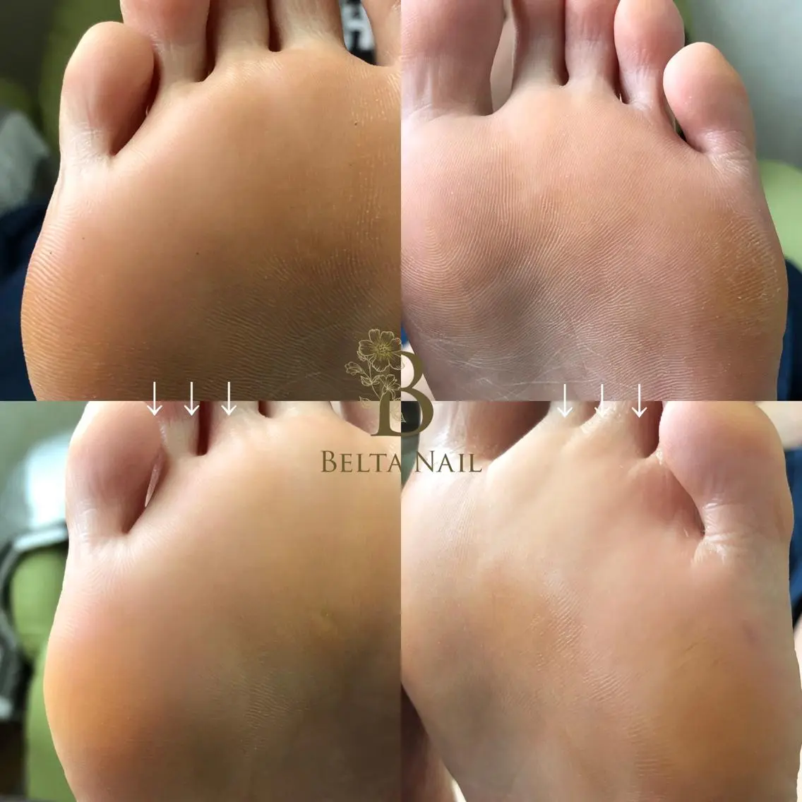ネイル その他(ネイル) BELTA NAILのネイルデザイン