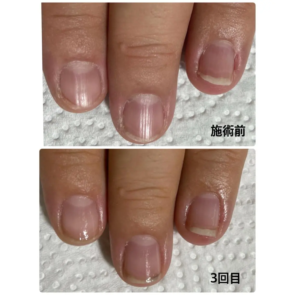 ネイル ジェルネイル ピンク スカルプネイル フィルイン/爪育成♡ 40代からのサロンのネイルデザイン