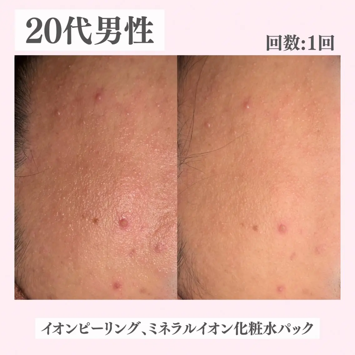 エステ リラク ニキビ・肌質改善専門 ♡人生が変わるサロンのエステ・リラクイメージ