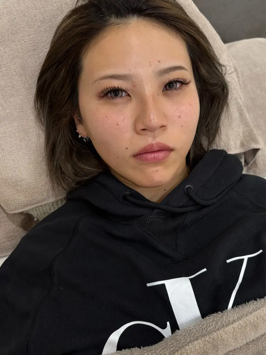 【ご新規様】形状記憶デザインキープラッシュ(LED)付け放題オフ込みの写真