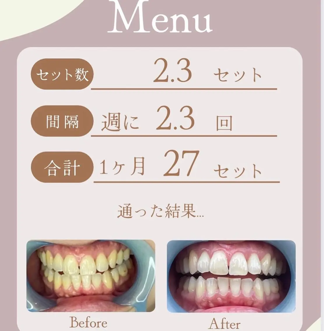 LAVISH 大和店 🤱子連れ大歓迎のネイルデザイン