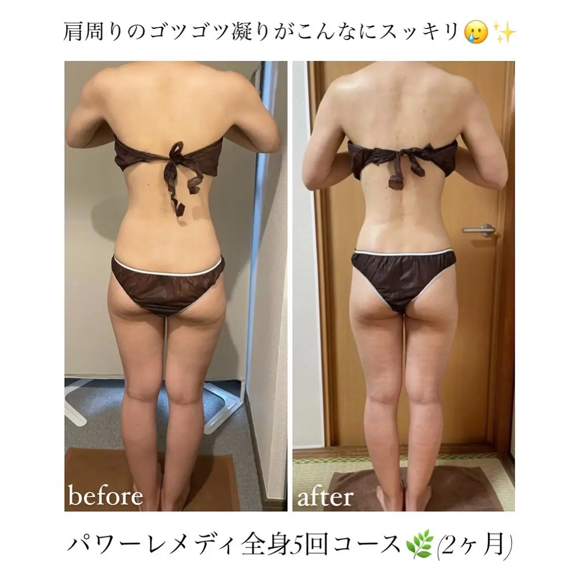 《本気痩せ×疲労改善 》 BILOOPのエステ・リラクイメージ