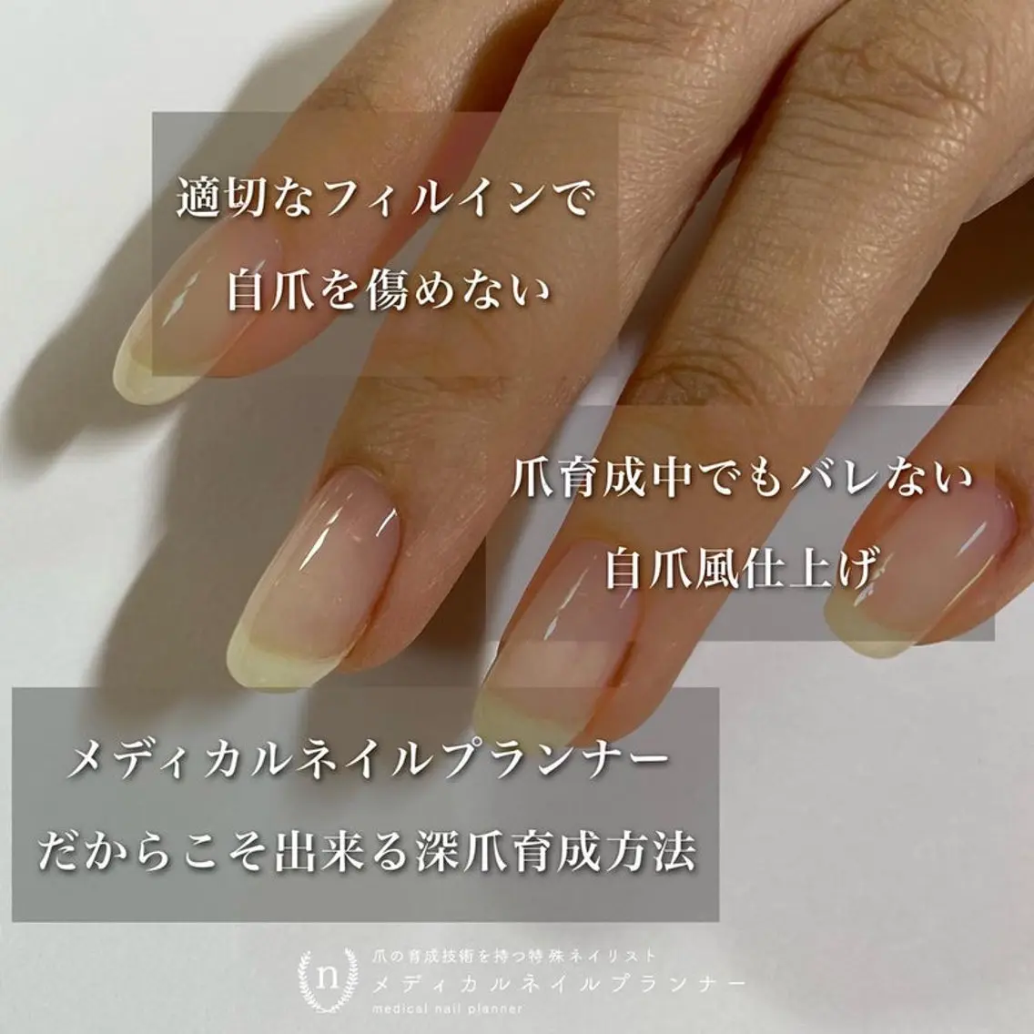 深爪育成(お持ち帰り頂けるネイルオイル込み)の写真