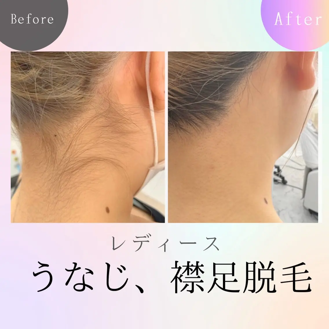 メンズ キッズ 脱毛 エステサロン さらのエステ・リラクイメージ