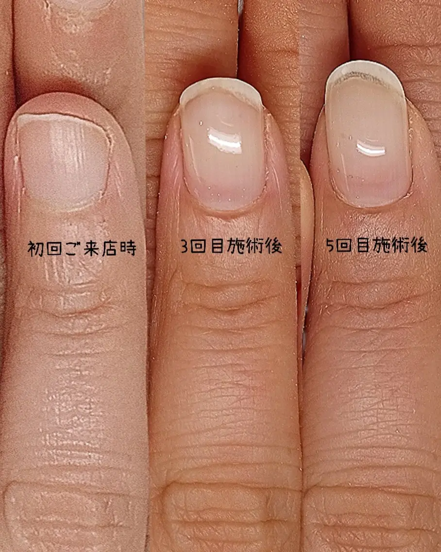 ネイル ハンドネイル 【まみ】 Ka Pilinaのネイルデザイン