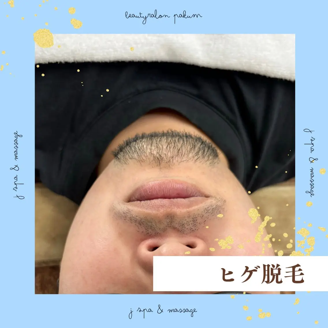 【メンズ専用】ヒゲ脱毛💥清潔感＆好印象UP✨の写真