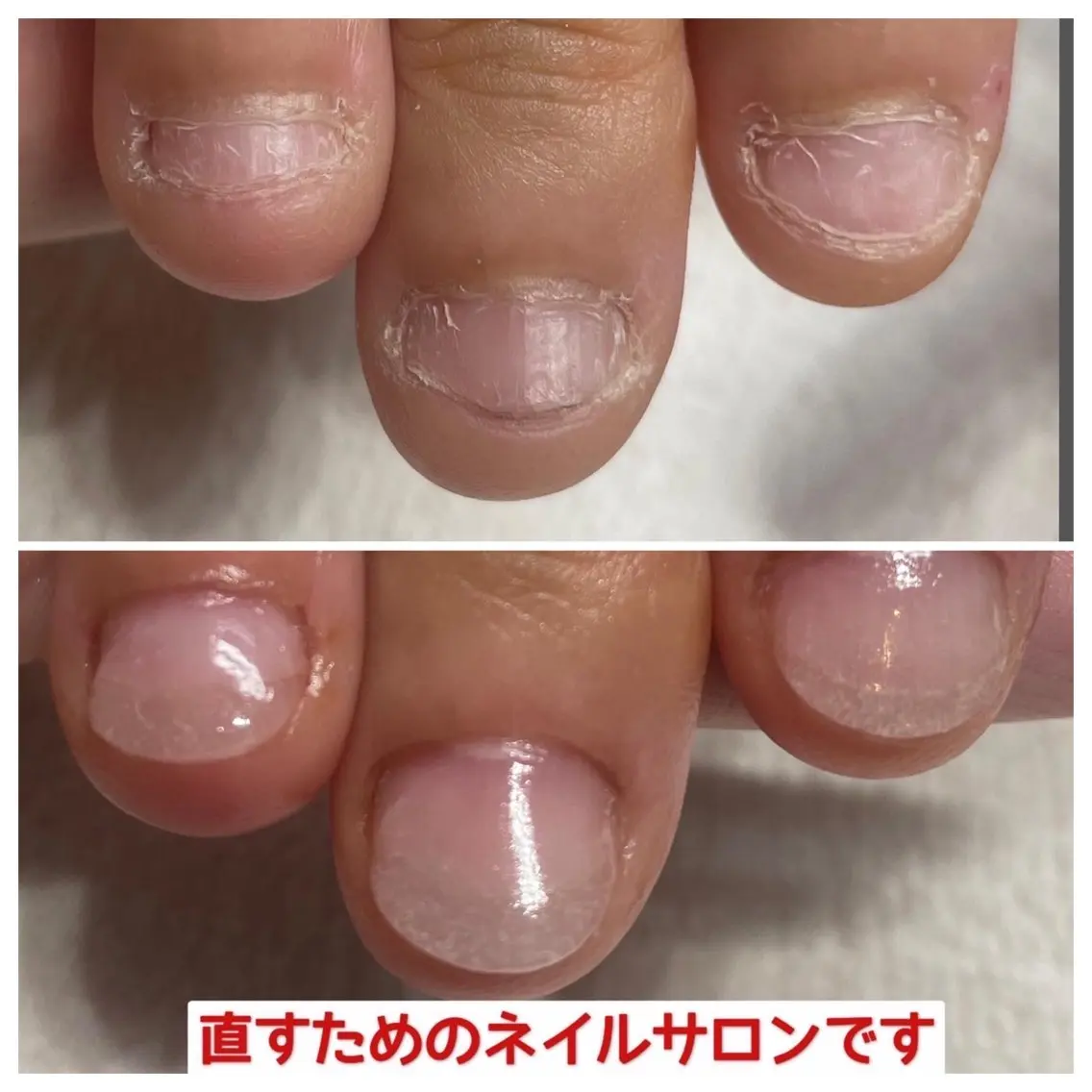 モニター【深爪】 補足説明を必ずお読みください！16500→9900の写真