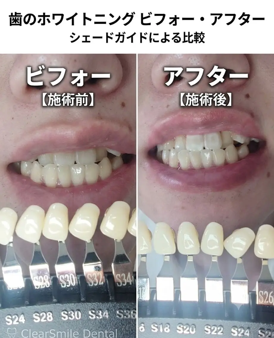 ホワイトニングサロン MYS自由が丘店のその他イメージ