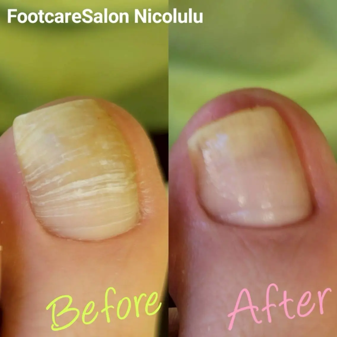 Nicolulu 金沢店のエステ・リラクイメージ