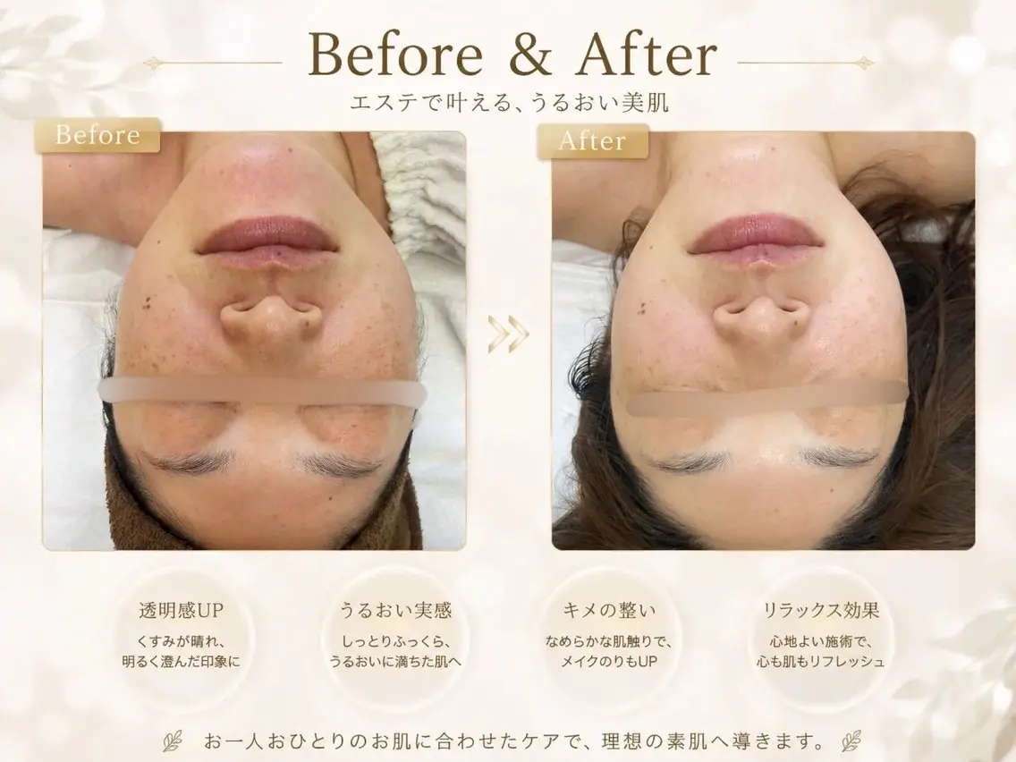 石膏パックを使った極上エステの写真