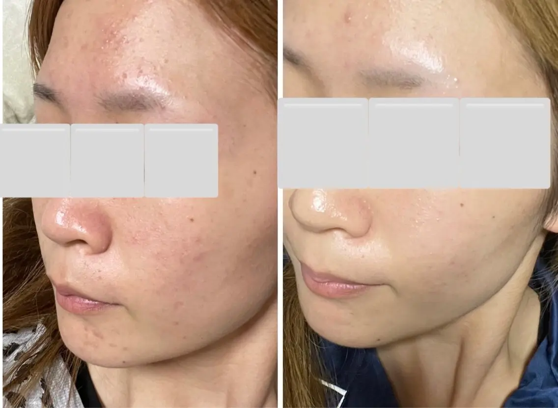 まつげとお肌のサロン M*s eyeのエステ・リラクイメージ