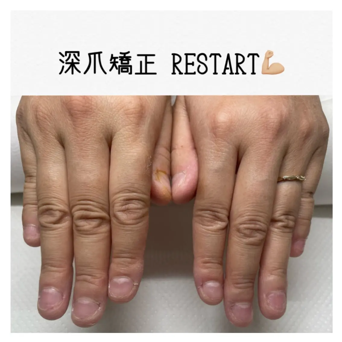ネイル nail salon petillantのネイルデザイン