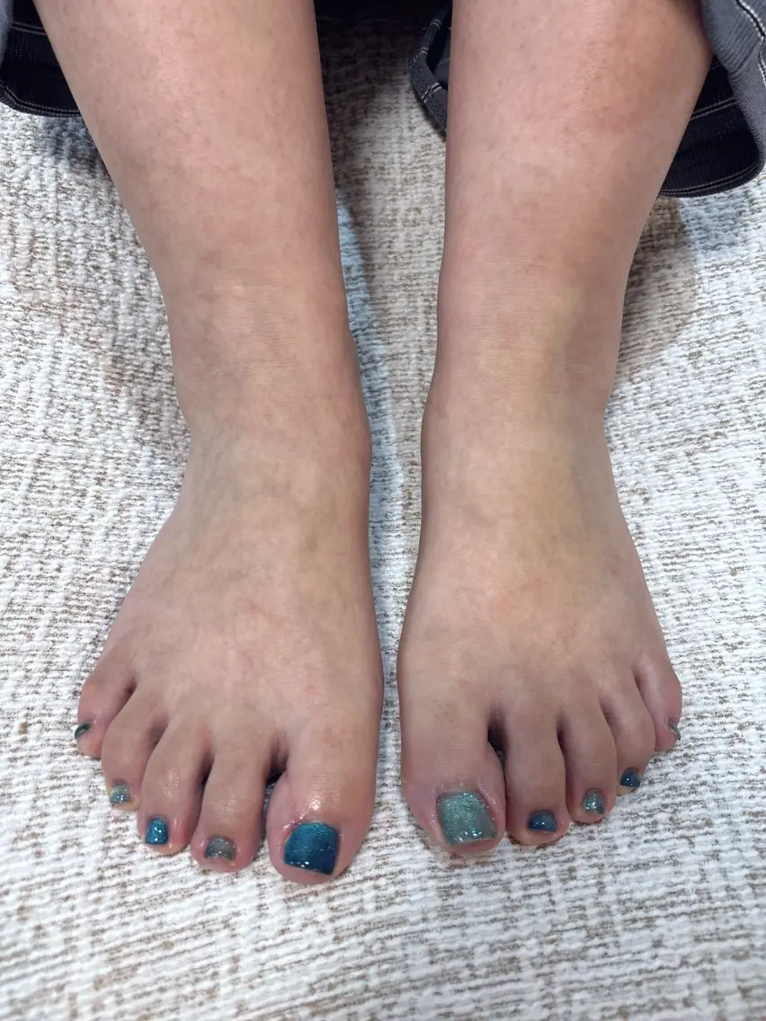 ネイル フットネイル Rei / U.NI nailのネイルデザイン
