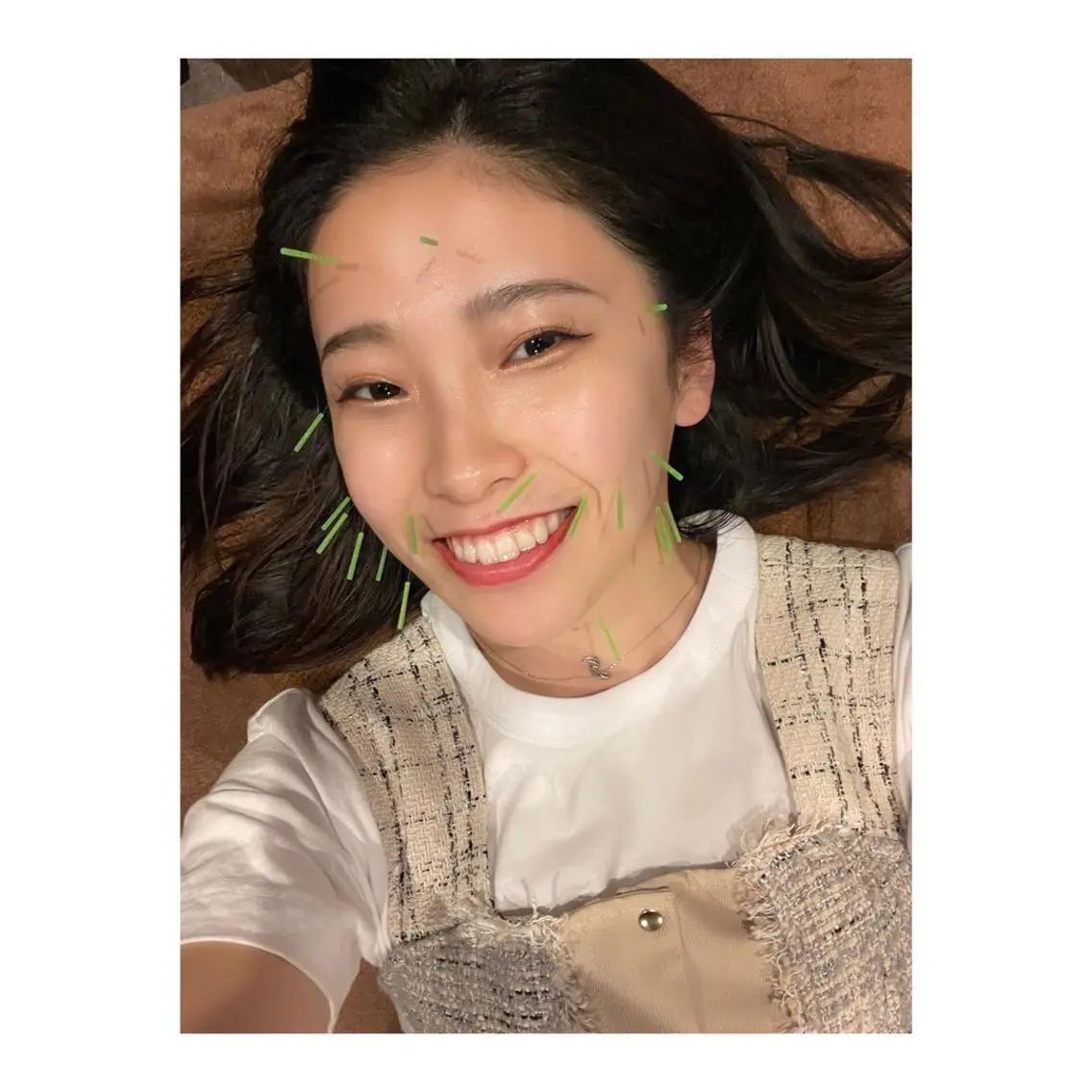 メンズ エステ リラク 美容鍼灸サロン LOMIHARIのエステ・リラクイメージ