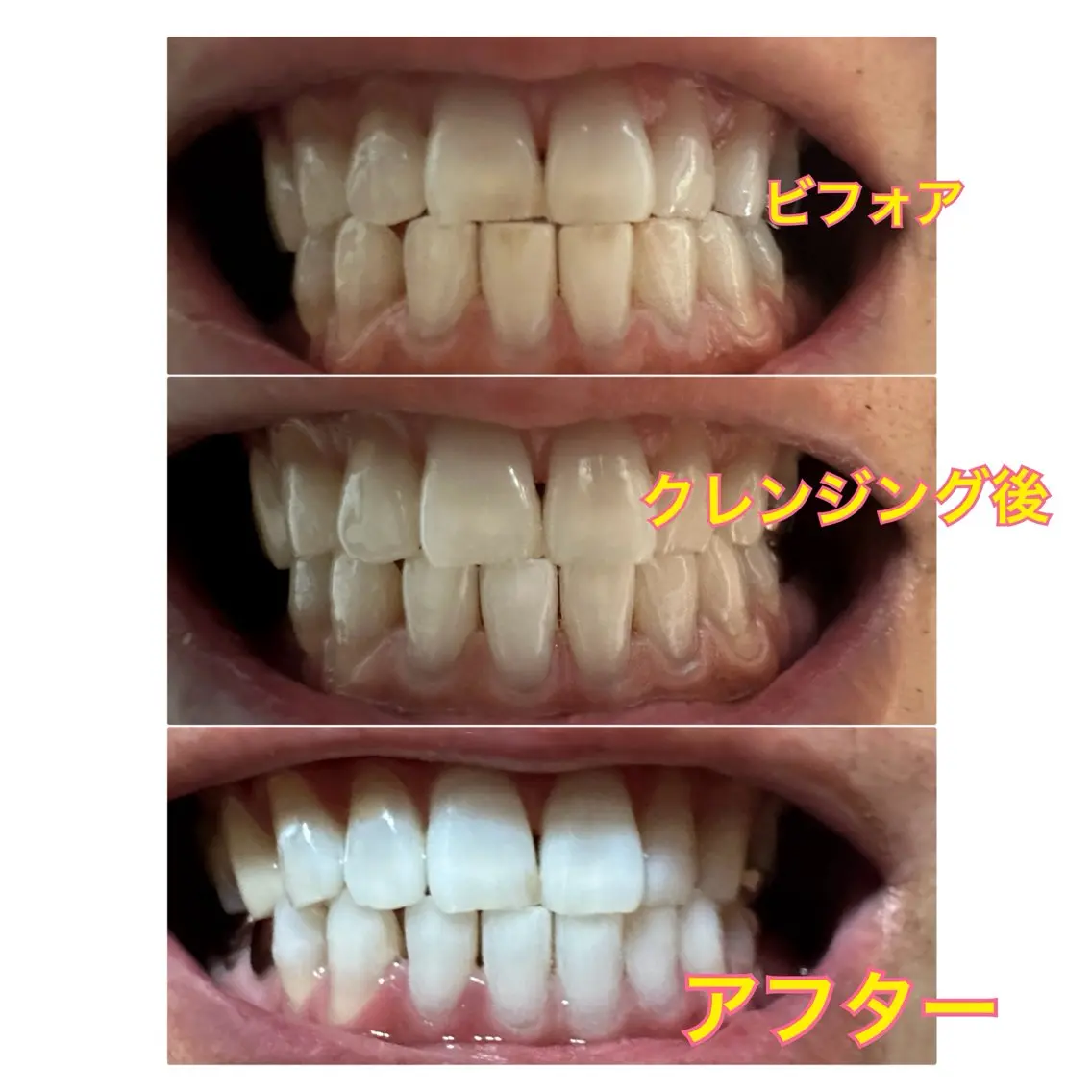 その他 ホワイトニングジム 池袋のその他イメージ
