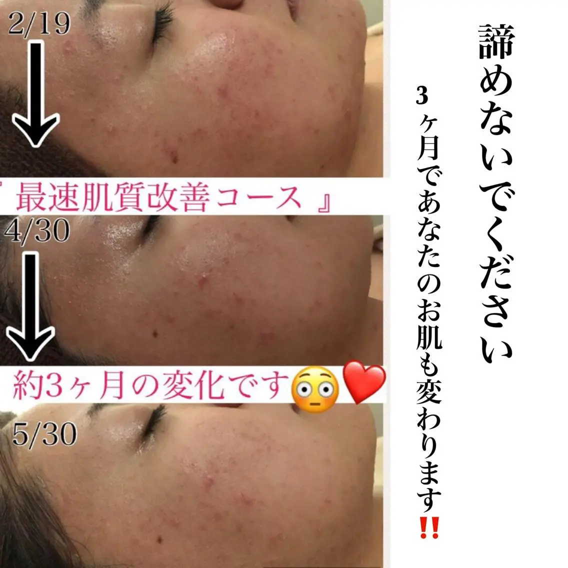 ミディアム カラー パーマ ヘアアレンジ メンズ キッズ ネイル マツエク・マツパ エステ リラク ニキビ・肌質改善専門 ♡人生が変わるサロンのエステ・リラクイメージ