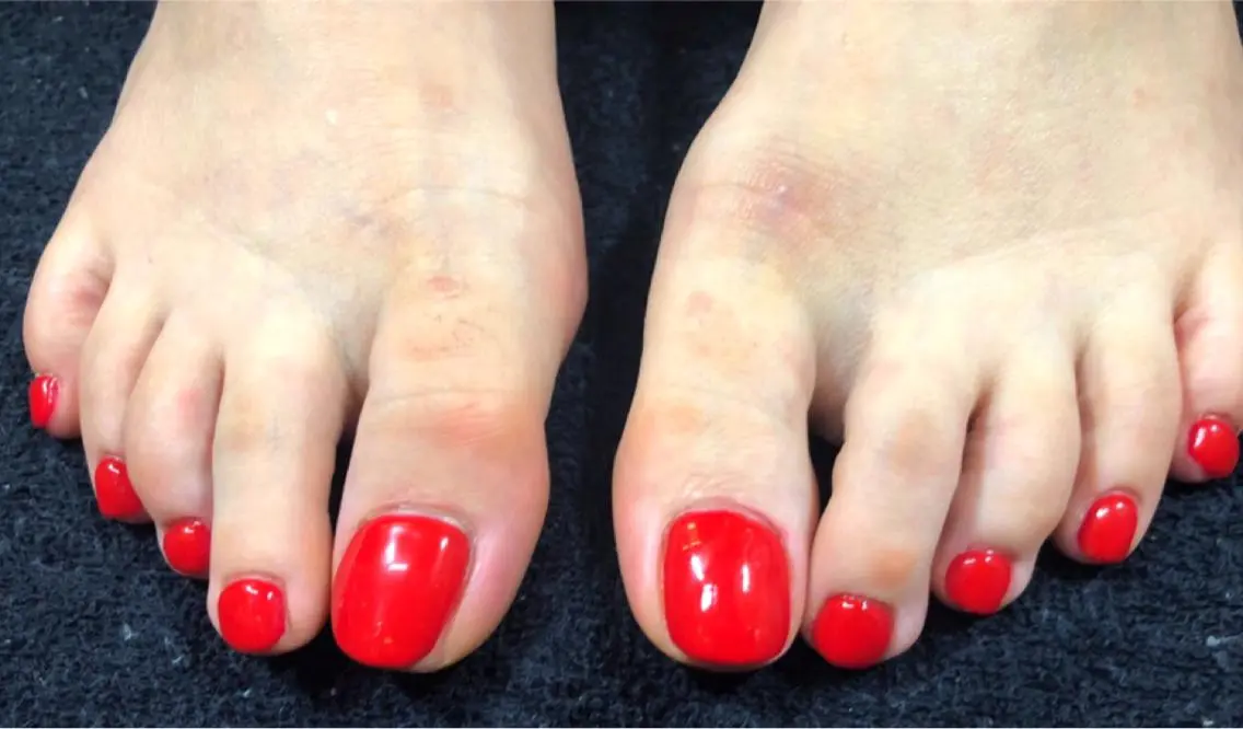 ✨新規様✨【ジェルオフ無料】フット👣ワンカラーの写真
