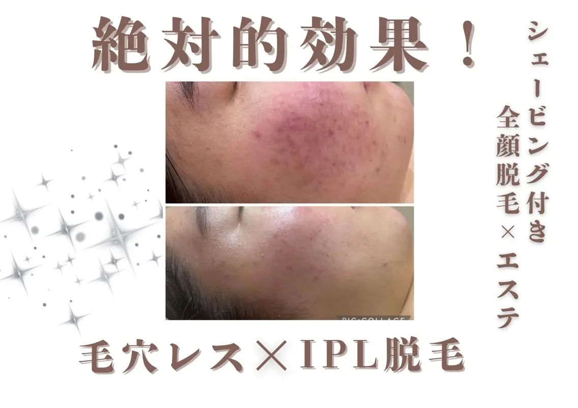 エステ 🎀美肌ケアサロン 🎀レイビス銀座店のエステ・リラクイメージ