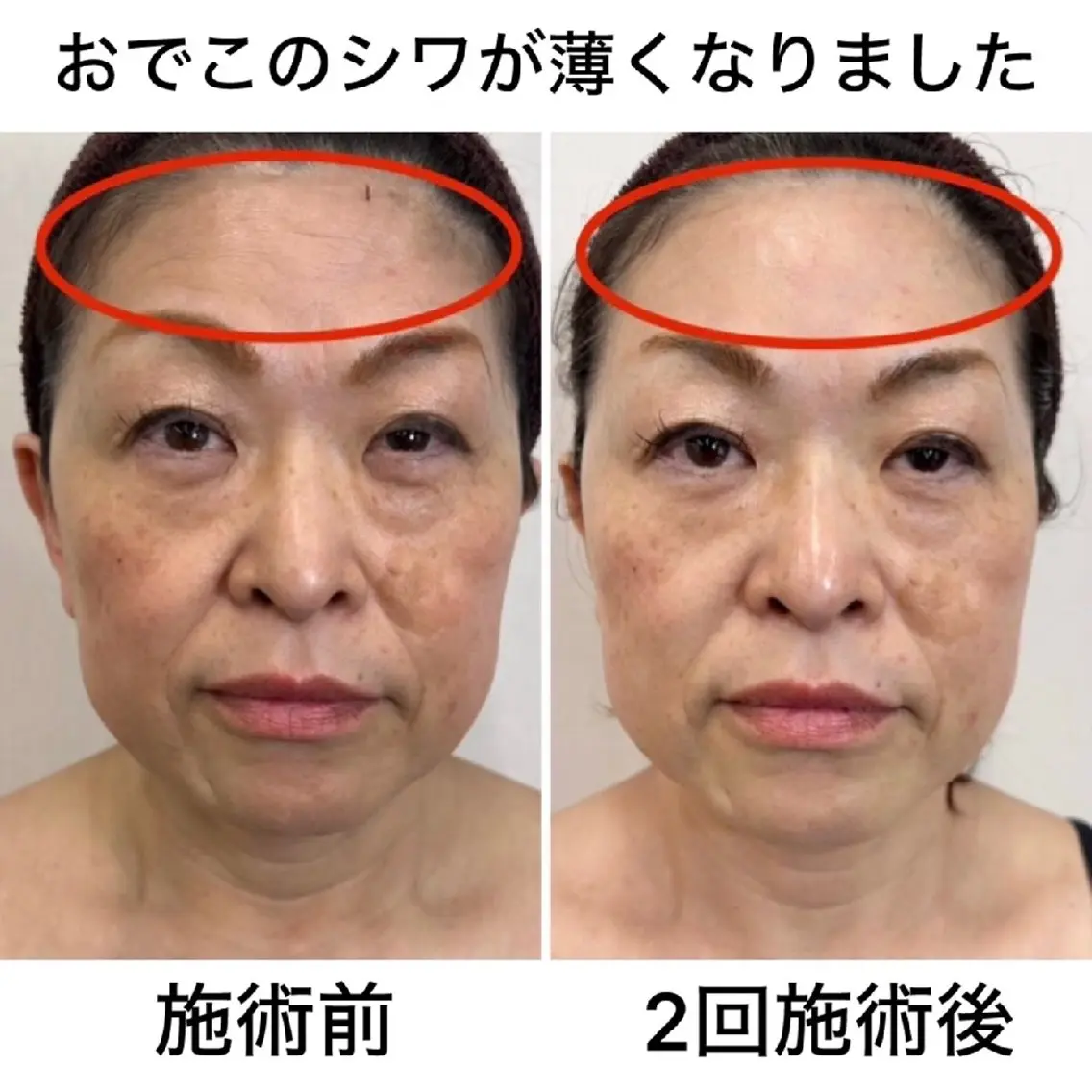 メンズ キッズ 脱毛*エステ*リラク 猫の手【丸田和可子】のエステ・リラクイメージ