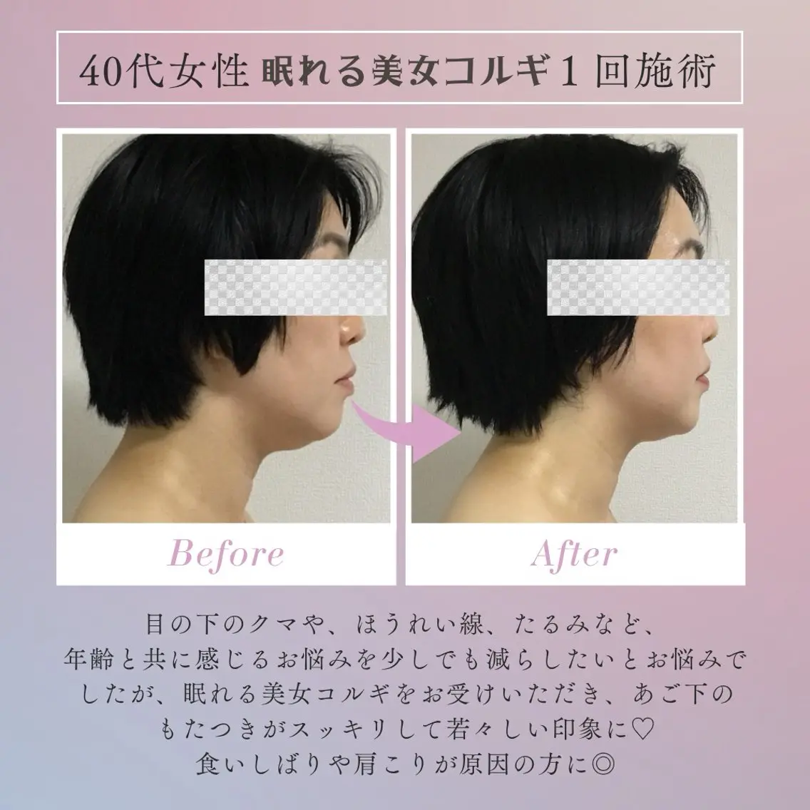 エステ MO MOのエステ・リラクイメージ
