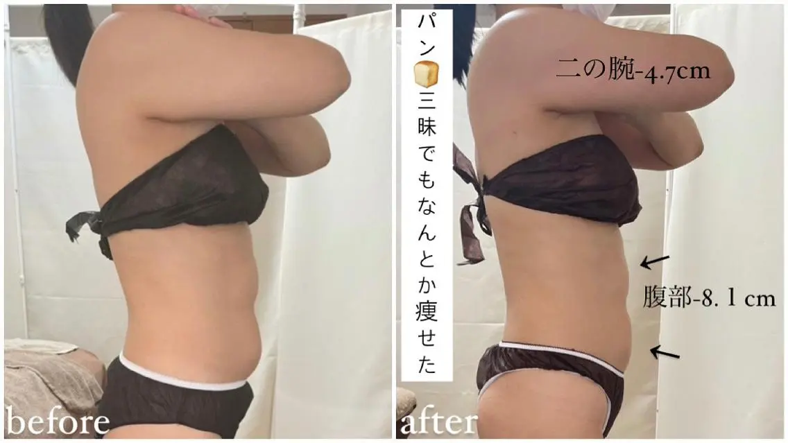 《本気痩せ×疲労改善 》  BILOOPのエステ・リラクイメージ