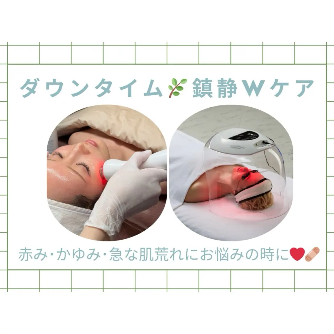【肌荒れ・赤み・ニキビ】鎮静ケアW🌿LDM×酸素導入O2toDermの写真