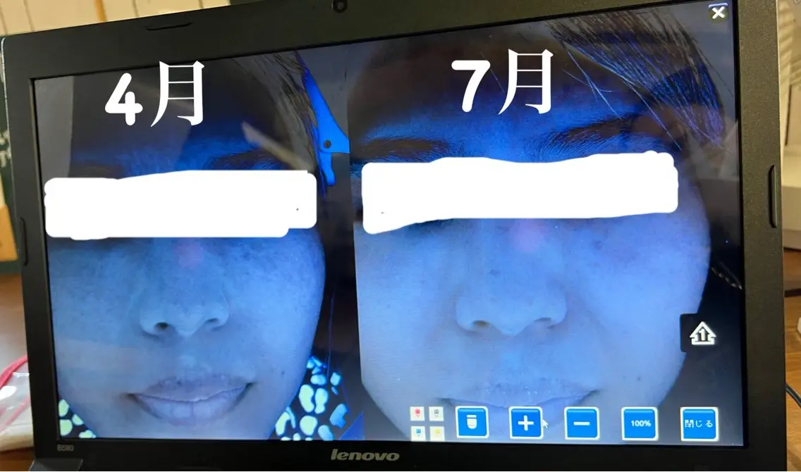 ダイエット痩身エステ ★MOOO＋のエステ・リラクイメージ