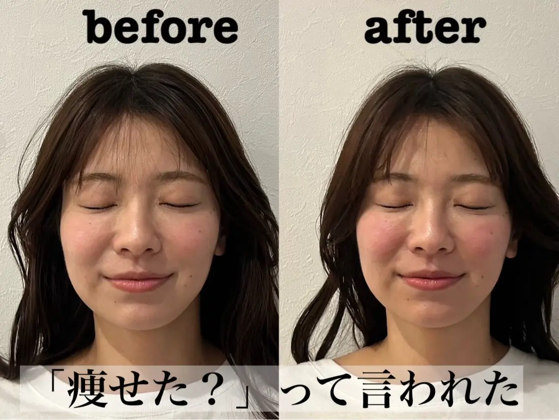 エステ リラク 大阪上本町 肌質改善×美容鍼ゆいのエステ・リラクイメージ